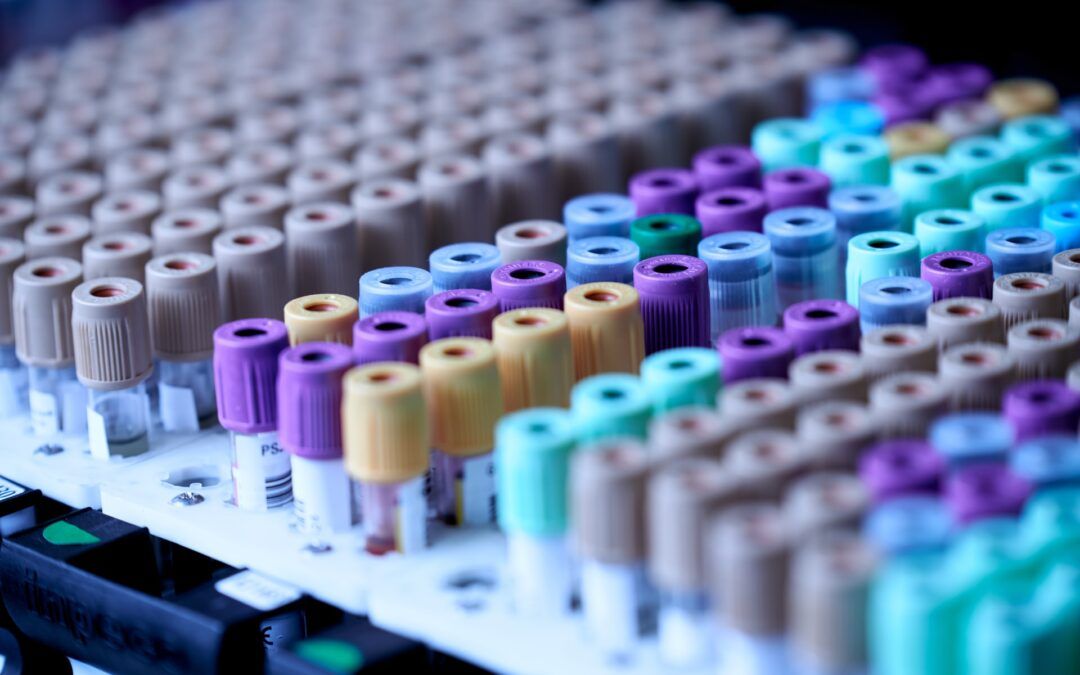 Interpretación de analíticas sanguíneas